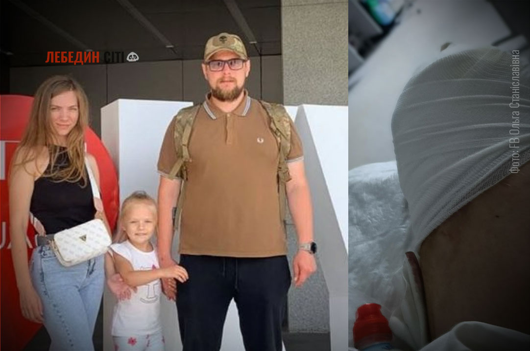 Захисник із Лебедина Дмитро Мякотін потребує допомоги: воїн отримав  поранення на фронті
