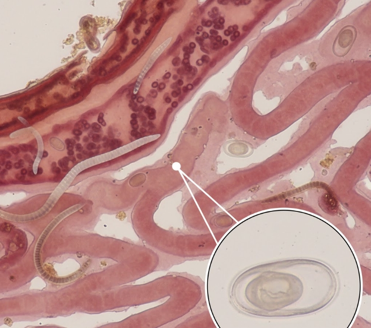 Епідемічна ситуація на Лебединщині: 11 випадків ентеробіозу та 3 укуси тварин