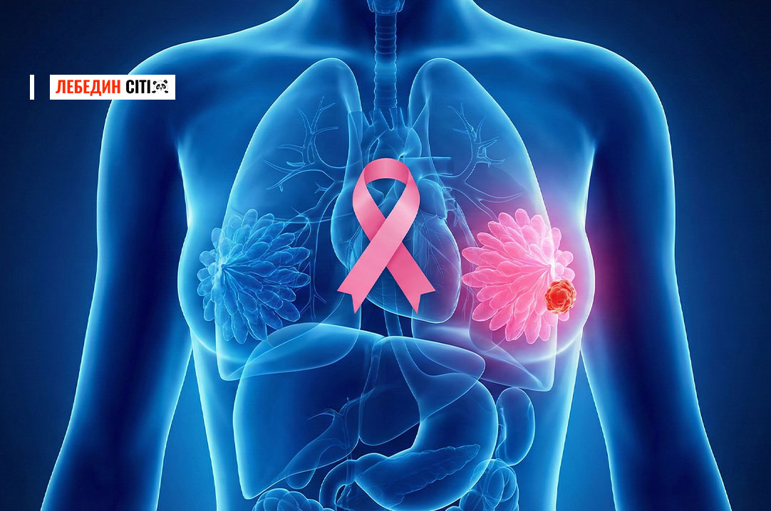 Як зменшити ризик захворіти на рак: статистика Сумщини та поради лікаря